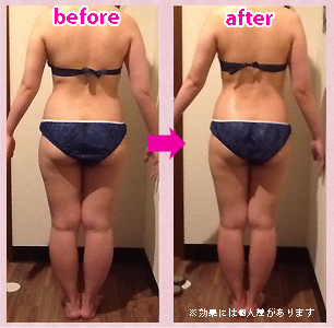 before・afterの違いをご覧!