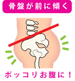 骨盤が前に傾いた状態